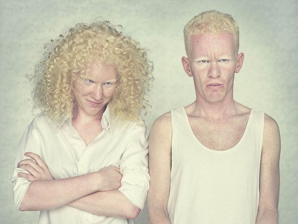 albinos_12.jpg