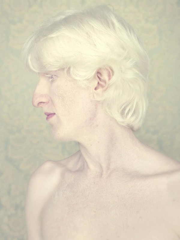 albinos_16.jpg