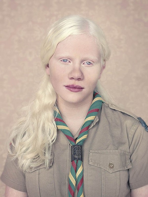 albinos_17.jpg