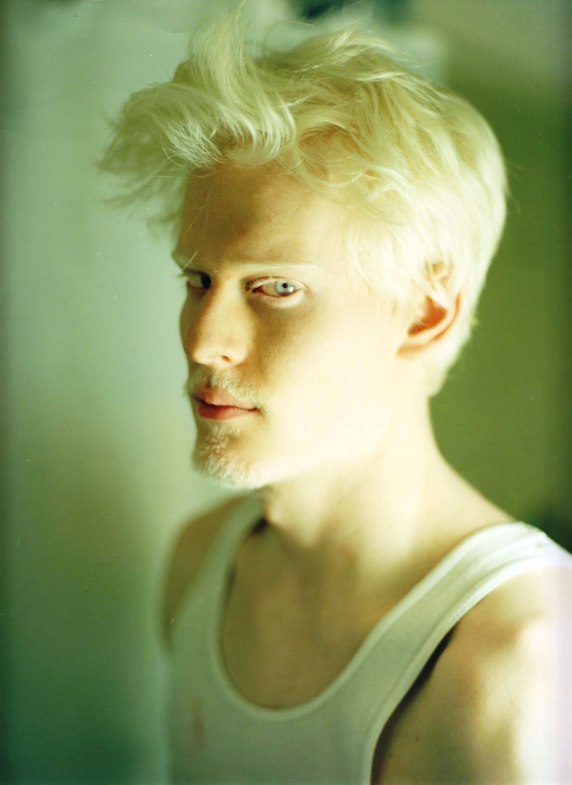 albinos_22.jpg