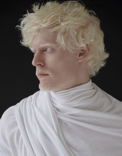 albinos_26.jpg