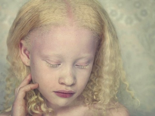 albinos_3.jpg