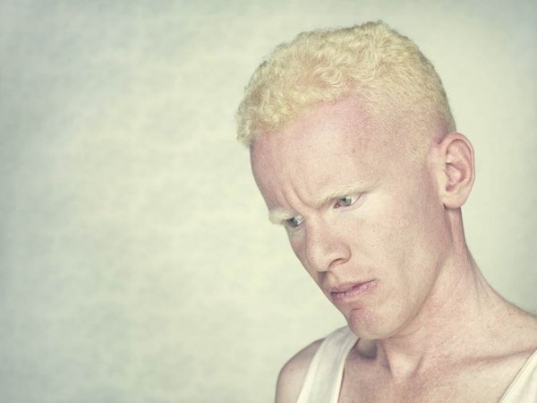 albinos_4.jpg