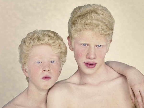 albinos_7.jpg