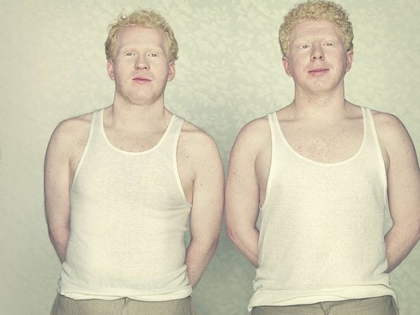 albinos_8.jpg
